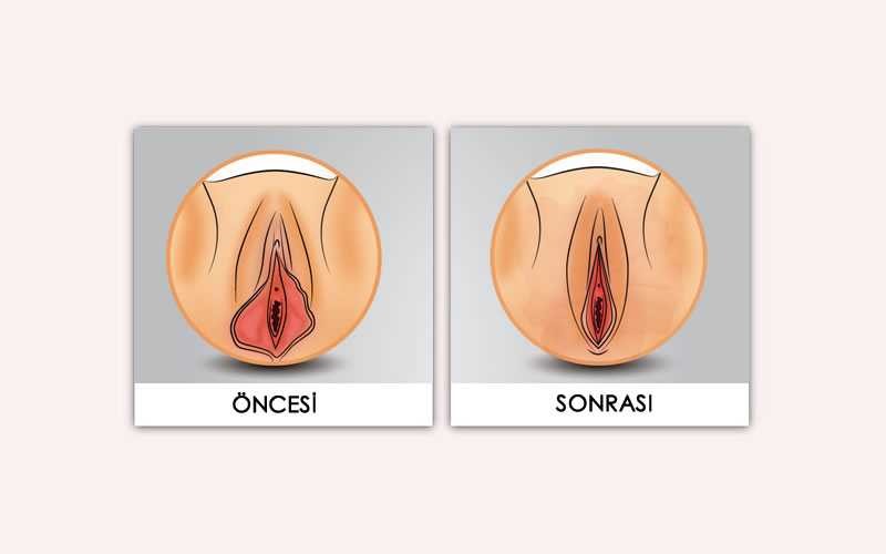 Cerrahı̇ Operasyonlar